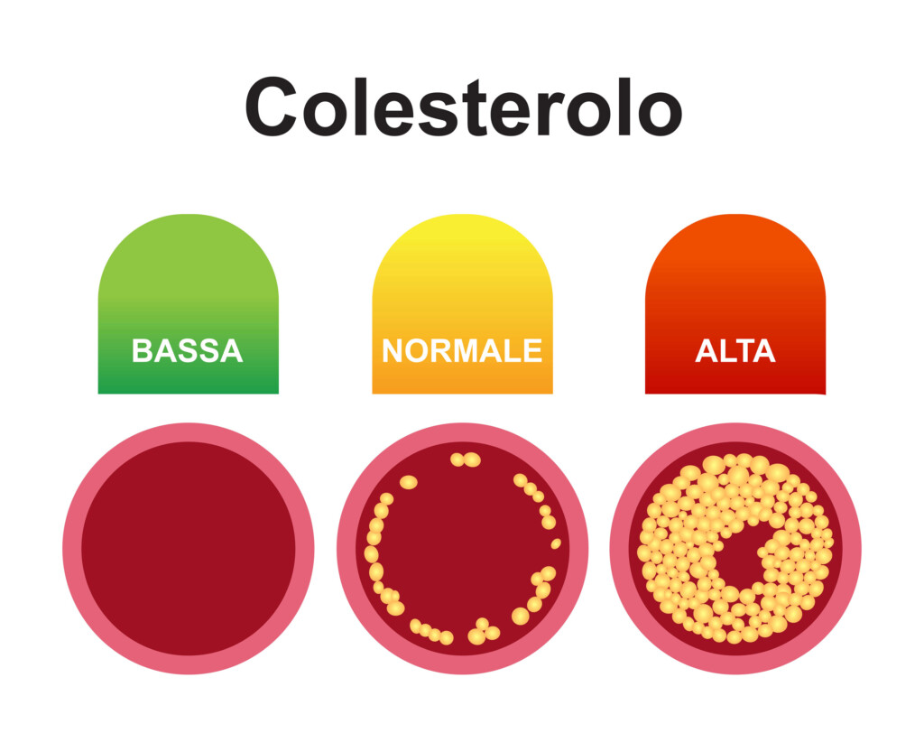 colestero grafico